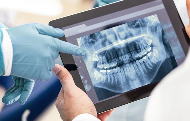 Zwei Hände, eine davon mit blauen Handschuhen, halten ein Tablet mit einer Röntgenaufnahme eines vollständigen Gebisses und Kiefers.