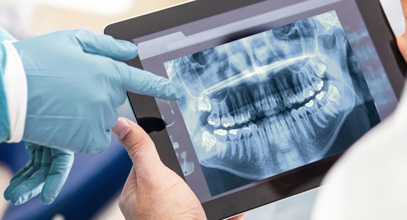 Zwei Hände, eine davon mit blauen Handschuhen, halten ein Tablet mit einer Röntgenaufnahme eines vollständigen Gebisses und Kiefers.