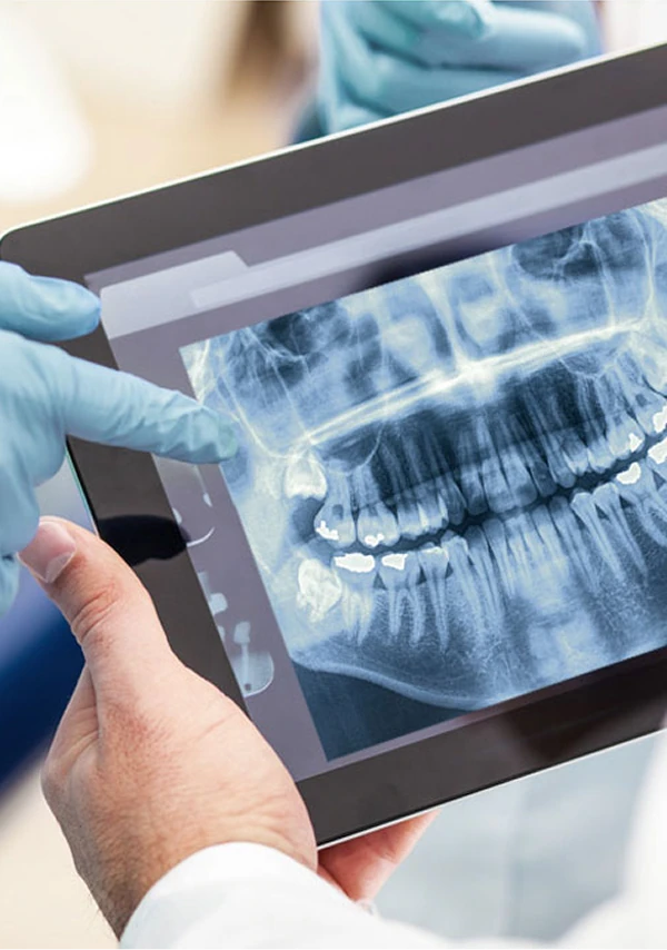 Zwei Hände, eine davon mit blauen Handschuhen, halten ein Tablet mit einer Röntgenaufnahme eines vollständigen Gebisses und Kiefers.